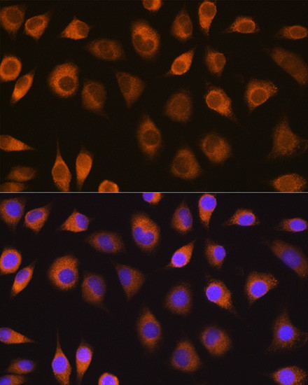 SEL1L Antibody in Immunocytochemistry (ICC/IF)