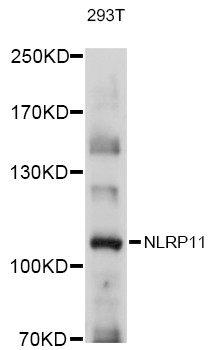 NALP11 Antibody in Western Blot (WB)