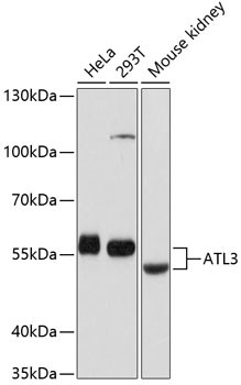 ATL3 Antibody in Western Blot (WB)