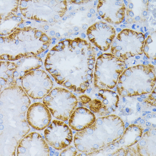 MEK1 Antibody in Immunohistochemistry (Paraffin) (IHC (P))