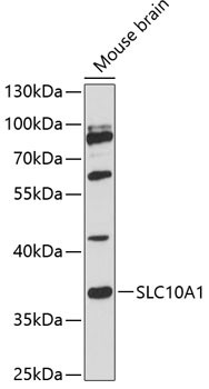 NTCP Antibody in Western Blot (WB)