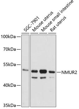 NMUR2 Antibody in Western Blot (WB)