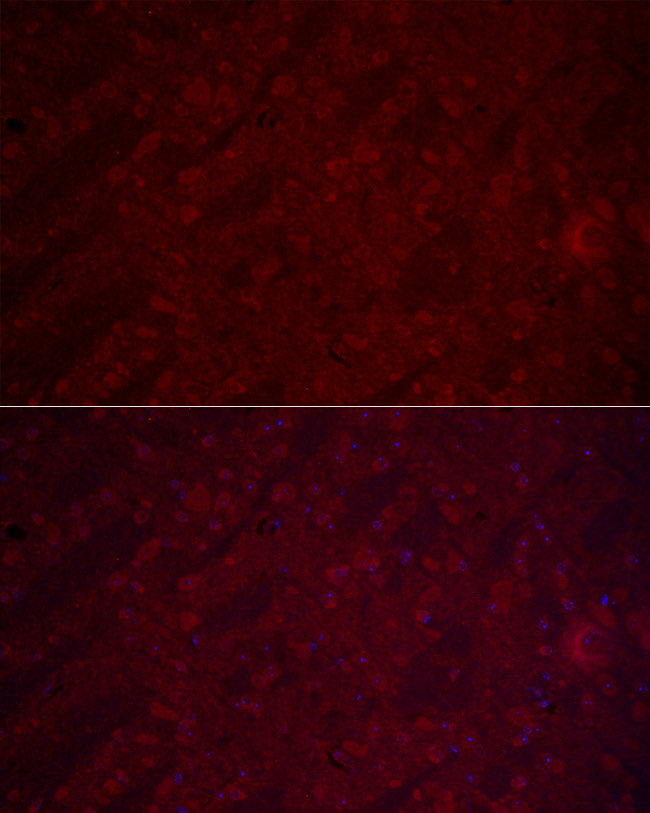 VGLUT1 Antibody in Immunocytochemistry (ICC/IF)