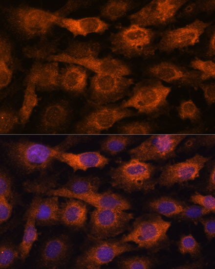 IFITM3 Antibody in Immunocytochemistry (ICC/IF)