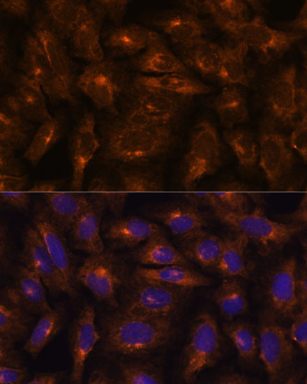 IFITM3 Antibody in Immunocytochemistry (ICC/IF)