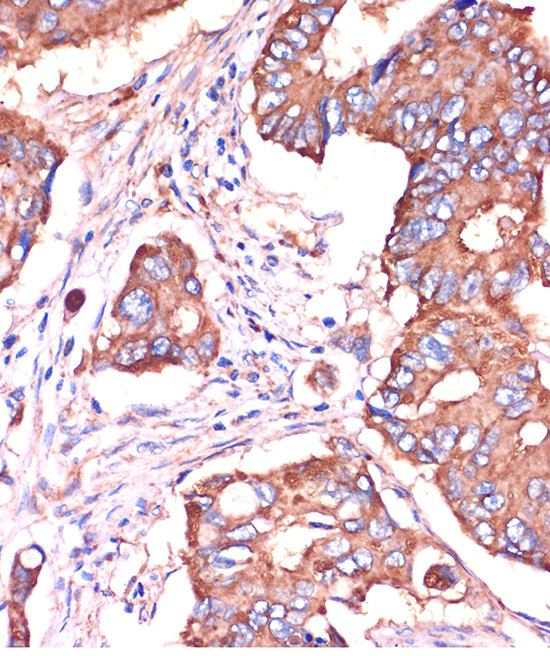 IFITM3 Antibody in Immunohistochemistry (Paraffin) (IHC (P))