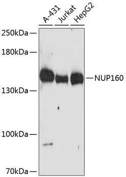 NUP160 Antibody in Western Blot (WB)