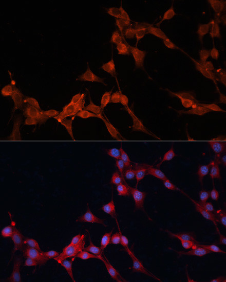 SLC25A38 Antibody in Immunocytochemistry (ICC/IF)