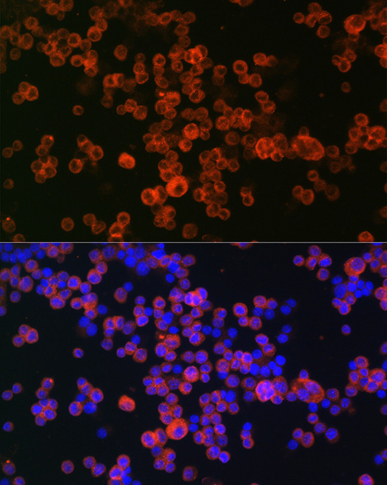 CD68 Antibody in Immunocytochemistry (ICC/IF)