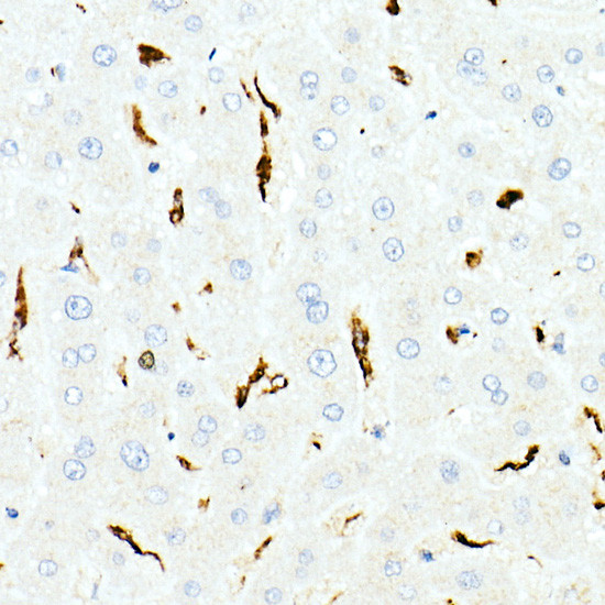 CD68 Antibody in Immunohistochemistry (Paraffin) (IHC (P))