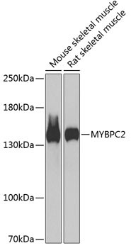 MYBPC2 Antibody in Western Blot (WB)