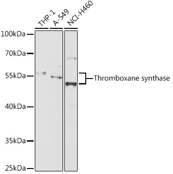 Thromboxane synthase Antibody in Western Blot (WB)