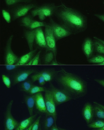 VCP Antibody in Immunocytochemistry (ICC/IF)