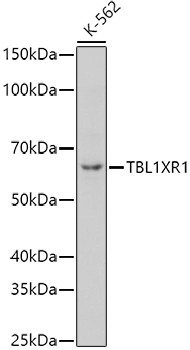 TBLR1 Antibody in Western Blot (WB)
