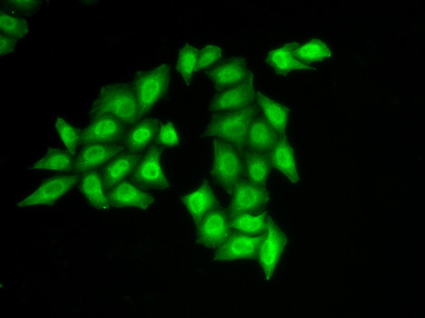 SSRP1 Antibody in Immunocytochemistry (ICC/IF)