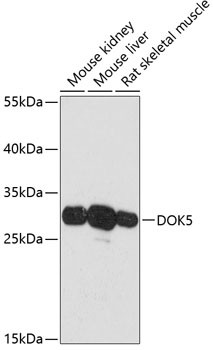 DOK5 Antibody in Western Blot (WB)