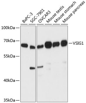 VSIG1 Antibody in Western Blot (WB)
