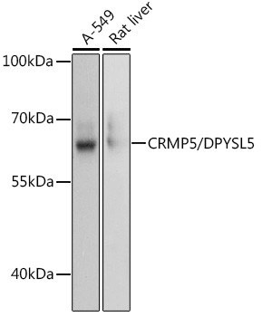 CRMP5 Antibody in Western Blot (WB)