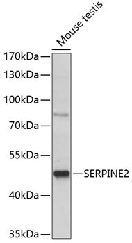 SERPINE2 Antibody in Western Blot (WB)