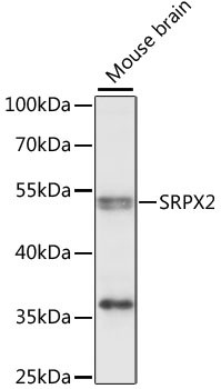 SRPX2 Antibody in Western Blot (WB)