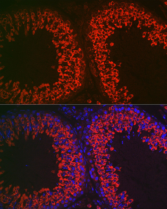 DDX4 Antibody in Immunocytochemistry (ICC/IF)