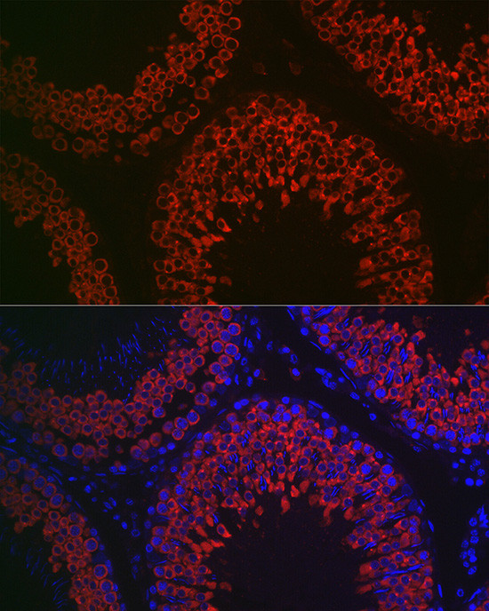 DDX4 Antibody in Immunohistochemistry (Paraffin) (IHC (P))