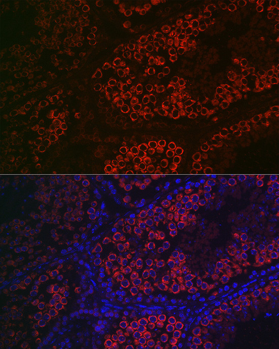 DDX4 Antibody in Immunohistochemistry (Paraffin) (IHC (P))