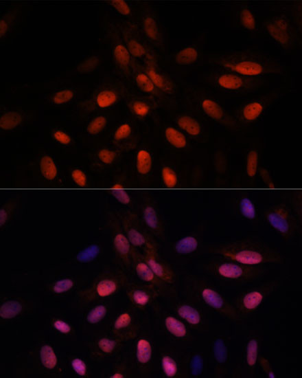 TPI1 Antibody in Immunocytochemistry (ICC/IF)