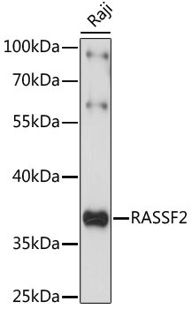 RASSF2 Antibody in Western Blot (WB)