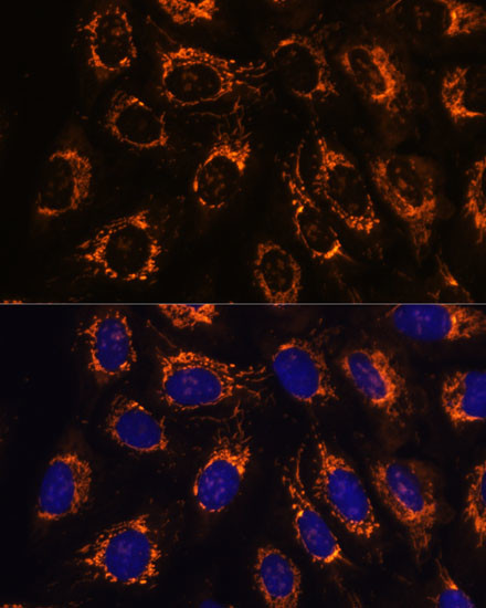 ACAA2 Antibody in Immunocytochemistry (ICC/IF)