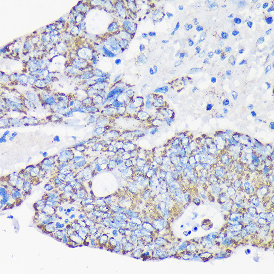 ACAA2 Antibody in Immunohistochemistry (Paraffin) (IHC (P))