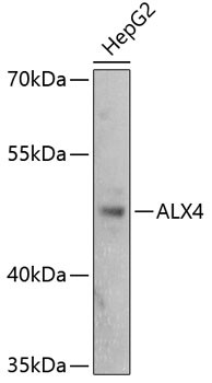 ALX4 Antibody in Western Blot (WB)