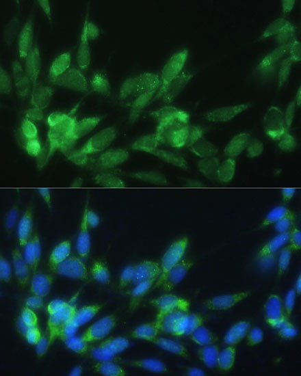 RAP Antibody in Immunocytochemistry (ICC/IF)