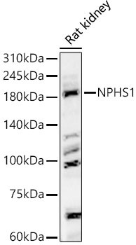 Nephrin Antibody in Western Blot (WB)