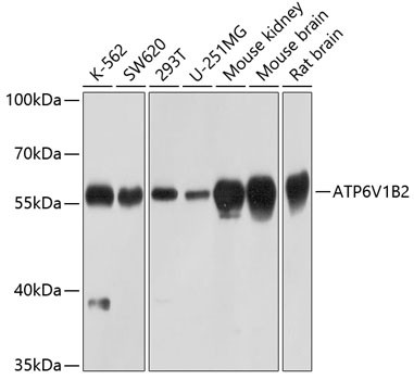 ATP6V1B2 Antibody in Western Blot (WB)