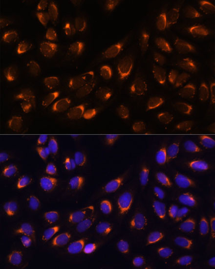 Nucleobindin 1 Antibody in Immunocytochemistry (ICC/IF)