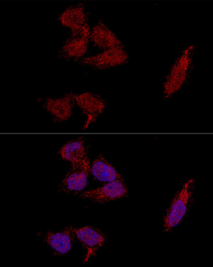 RPL23A Antibody in Immunocytochemistry (ICC/IF)