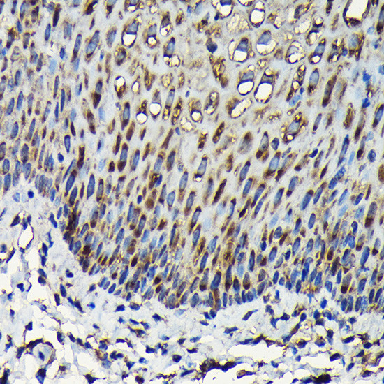 RPL23A Antibody in Immunohistochemistry (Paraffin) (IHC (P))