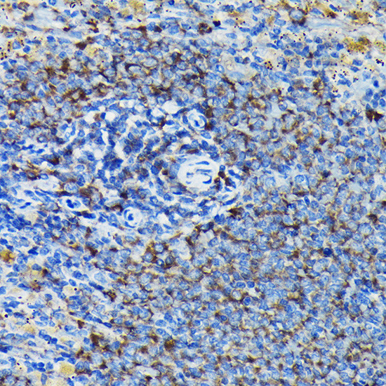 RPL23A Antibody in Immunohistochemistry (Paraffin) (IHC (P))