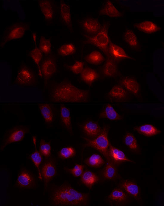 GHRH Antibody in Immunocytochemistry (ICC/IF)