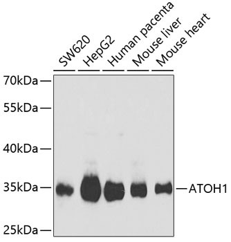 ATOH1 Antibody in Western Blot (WB)