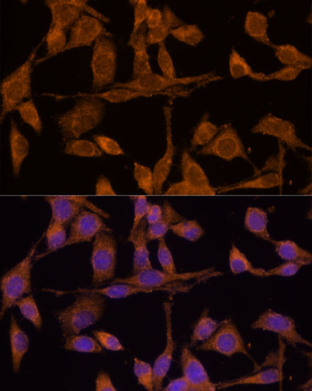 USP15 Antibody in Immunocytochemistry (ICC/IF)