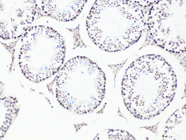 BCL9 Antibody in Immunohistochemistry (Paraffin) (IHC (P))