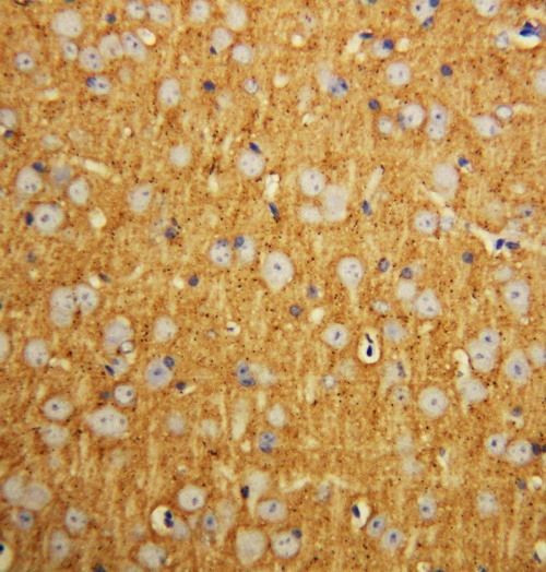 SNAP25 Antibody in Immunohistochemistry (Paraffin) (IHC (P))