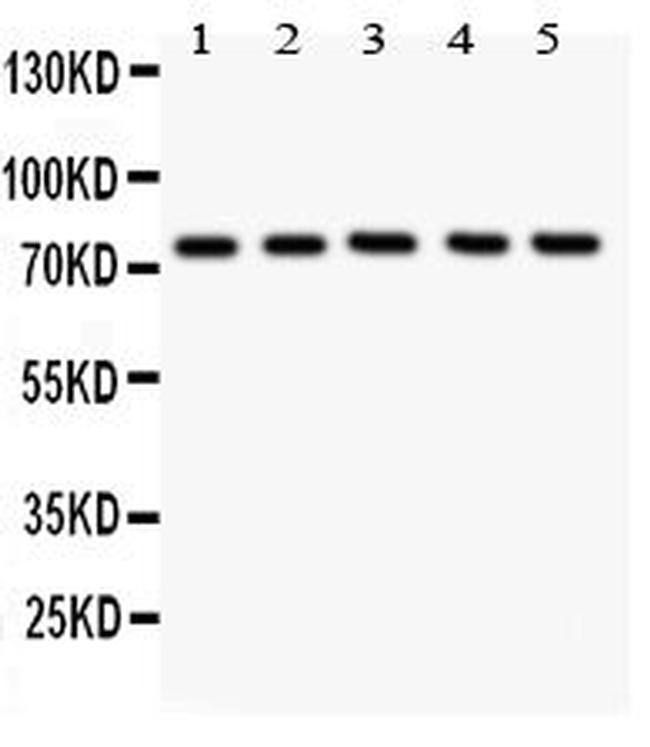 ALOX12 Antibody in Western Blot (WB)