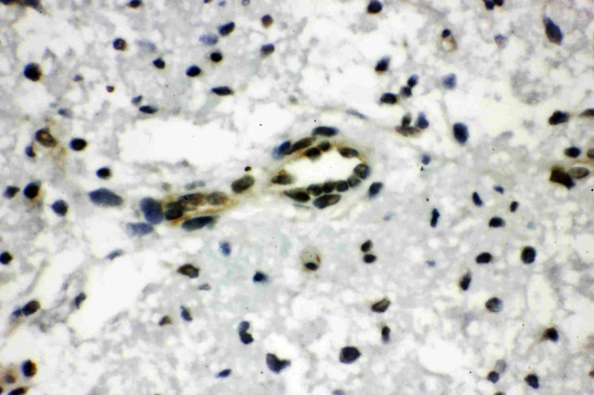 CtBP1 Antibody in Immunohistochemistry (Paraffin) (IHC (P))