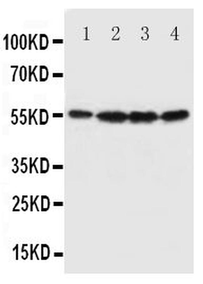 Fascin Antibody in Western Blot (WB)