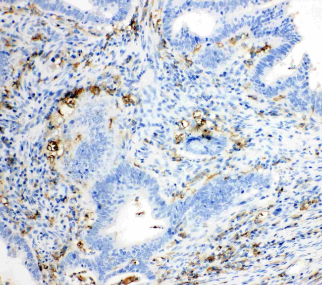 TRPC6 Antibody in Immunohistochemistry (Paraffin) (IHC (P))