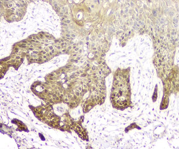 14-3-3 sigma Antibody in Immunohistochemistry (Paraffin) (IHC (P))