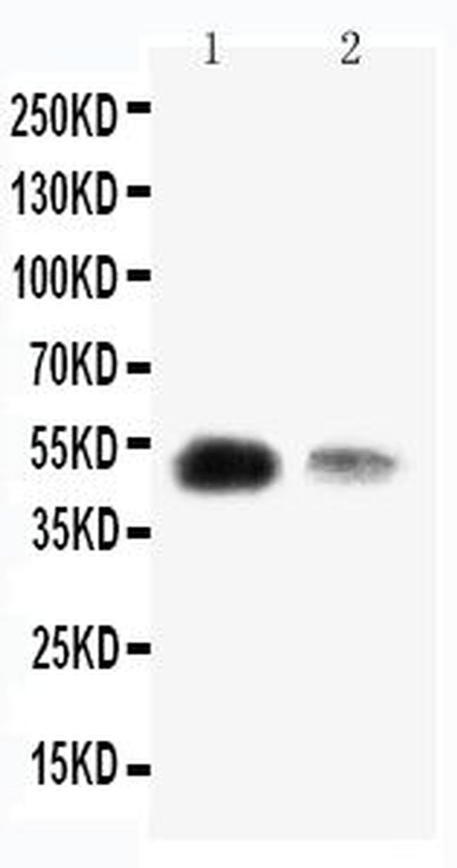 KLF8 Antibody in Western Blot (WB)